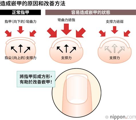 正常指甲長度|如何正確修剪指甲？日本專家：最好修剪成方形、每五。